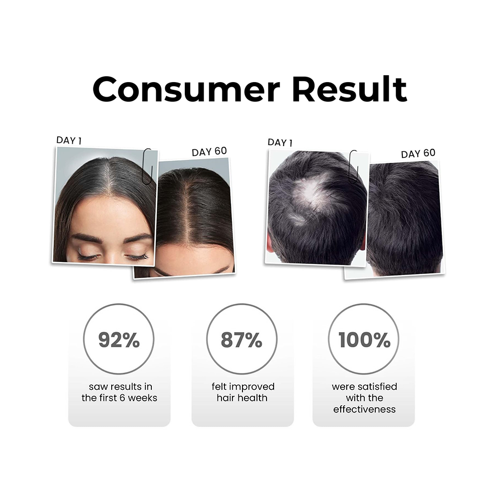 Nutrasource Anti-Hair Fall Shampoo | DHT Blocker | Backed by Korean Science & Hair Loss Vaccine Technology