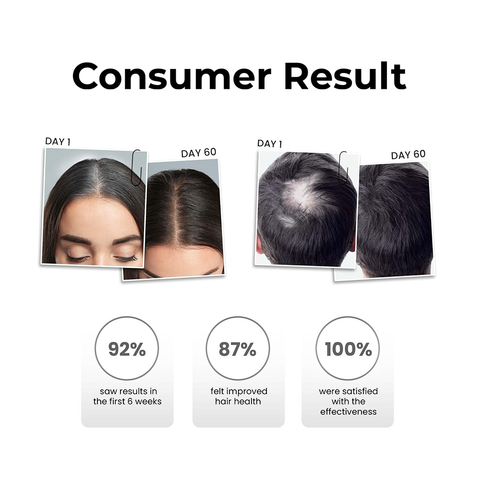 Nutrasource Hair Growth Serum | Backed by Korean Science | HL-V Technology with Oatmeal, Aliv Seeds, Triphala & Procapil | DHT Blocker