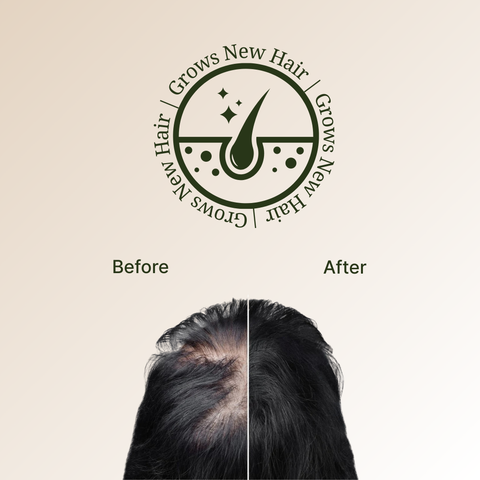 MAHA BHRINGRAJ ONION & HIBISCUS HAIR OIL 200 ML
